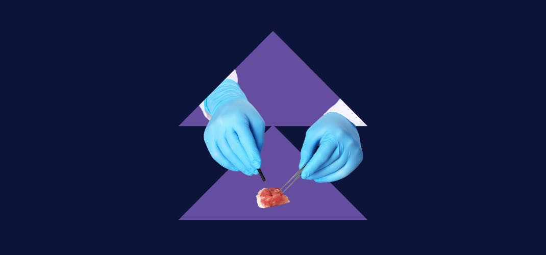 A picture of two vertical triangles on a plain background. Over the triangles there is a pair of animated hands in surgical gloves that appear to be manipulating a small piece of red meat using dissection kit equipment including a pair of tweezers.